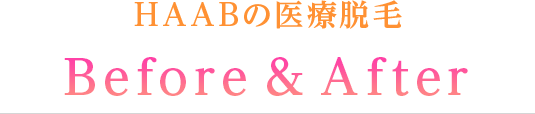 HAABの医療脱毛 Before&After
