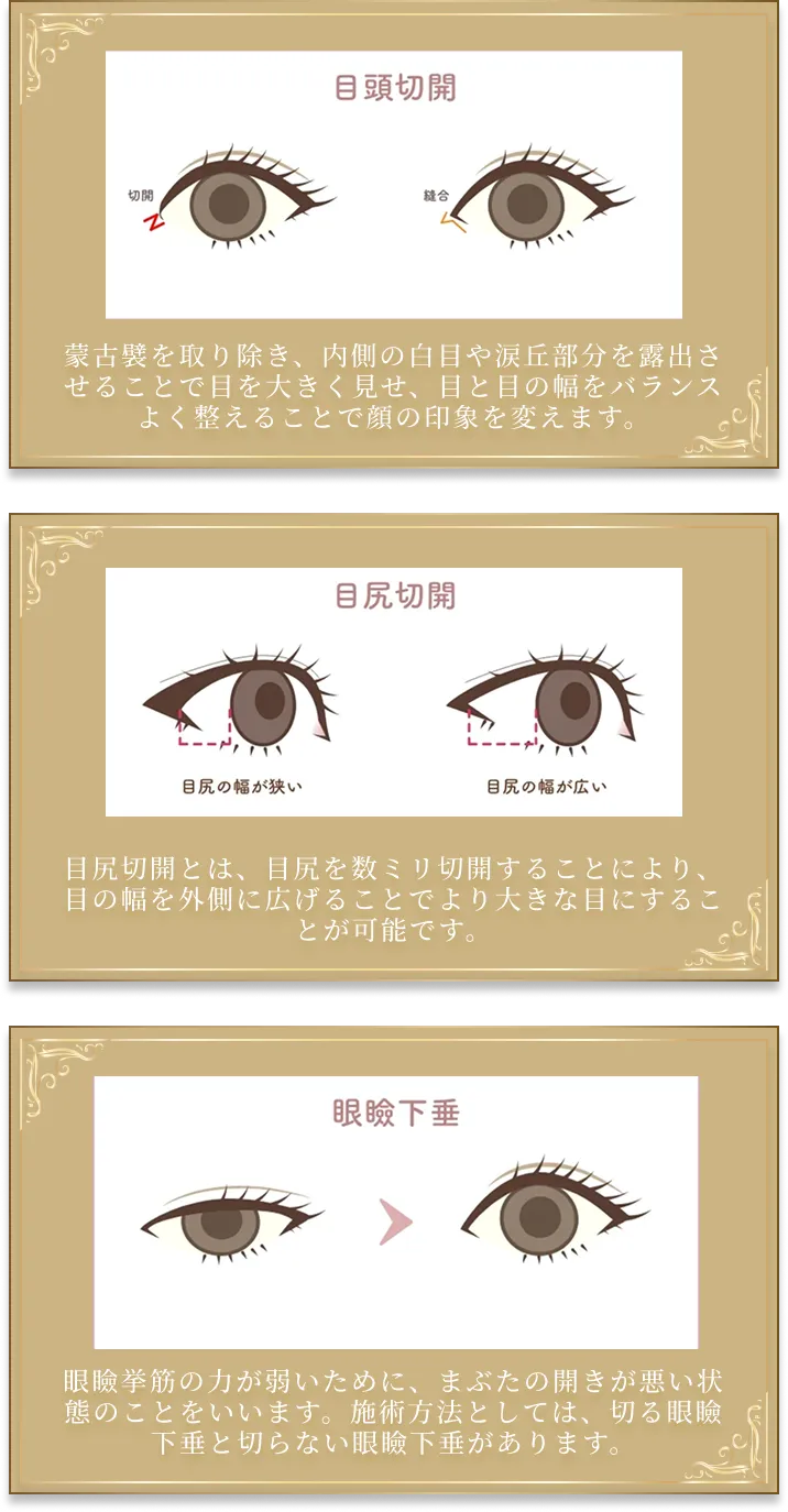 整形メニュー１