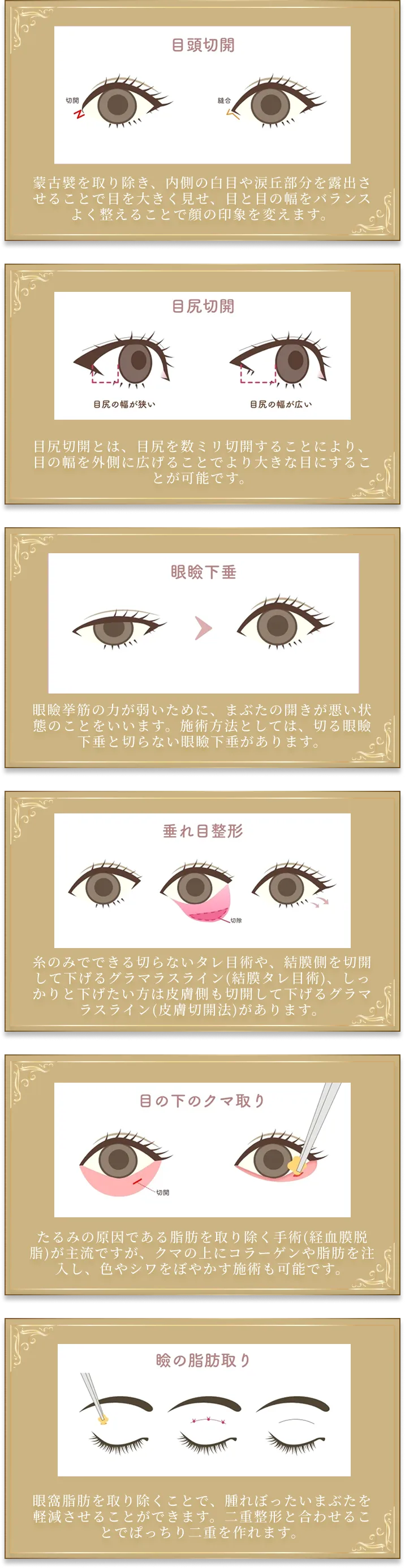 整形メニュー２