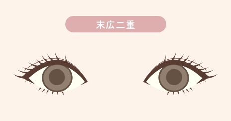 目の二重整形の末広二重の特徴