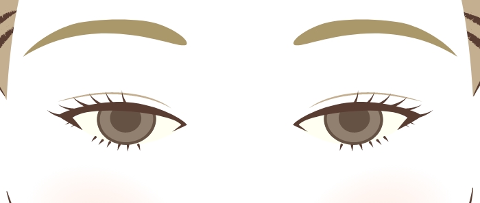 眼瞼下垂の人の特徴