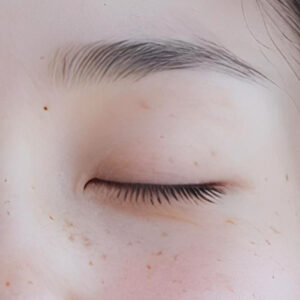 一重まぶたと二重まぶたの違いは？それぞれの特徴を解説