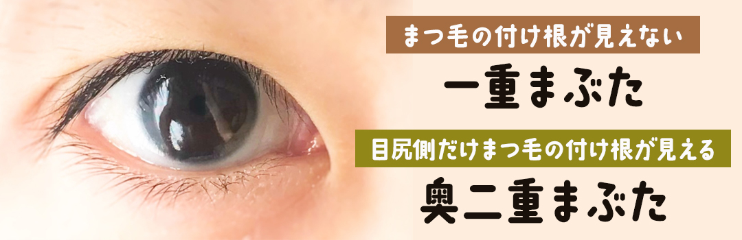 奥二重と一重の違いは？｜HAABクリニック