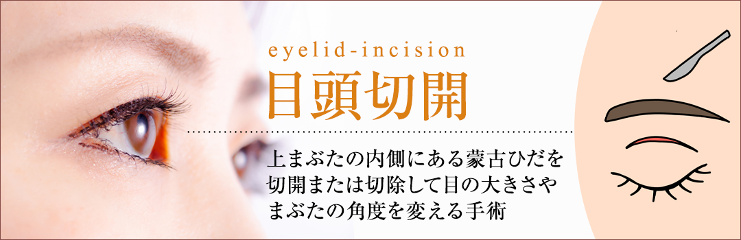 目頭切開の失敗例とは？｜HAABクリニック