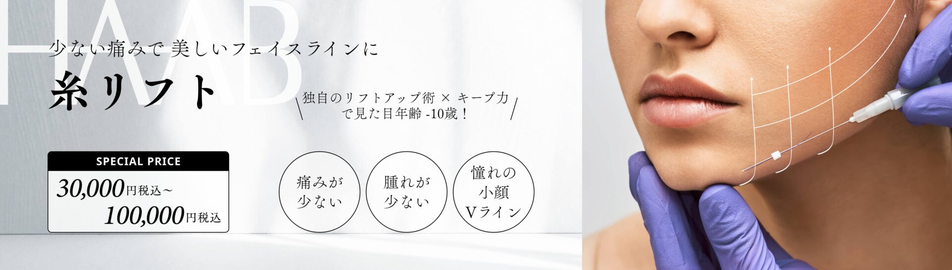 糸リフト
