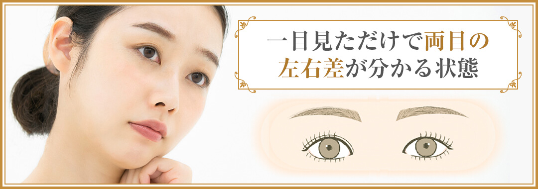 雄雌眼とは？一目見ただけで両目の左右差が分かる状態｜HAABクリニック