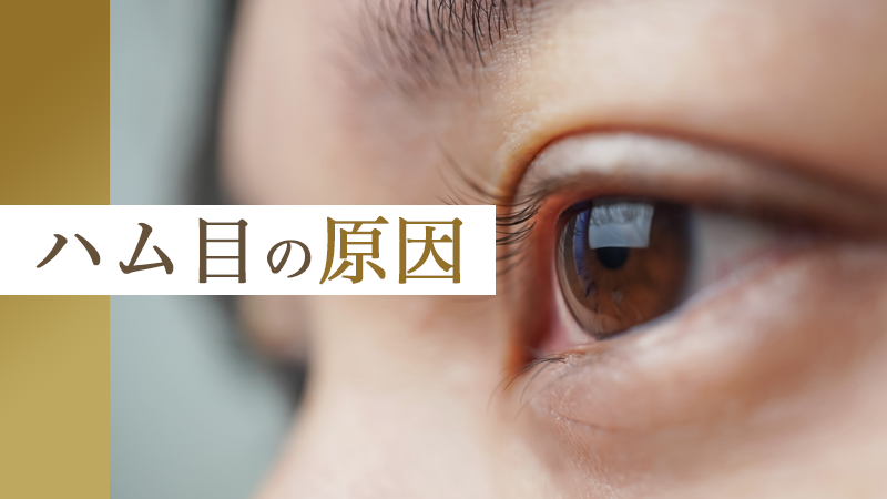 ハム目の原因｜HAABクリニック