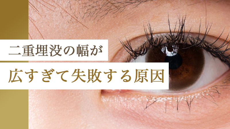 二重埋没の幅が広すぎて失敗する原因｜HAABクリニック