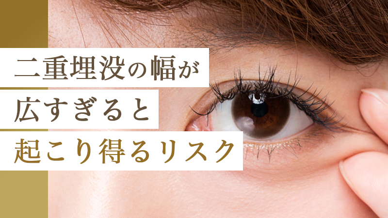 二重埋没の幅が広がりすぎると起こり得るリスク｜HAABクリニック