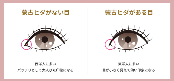 蒙古ヒダ