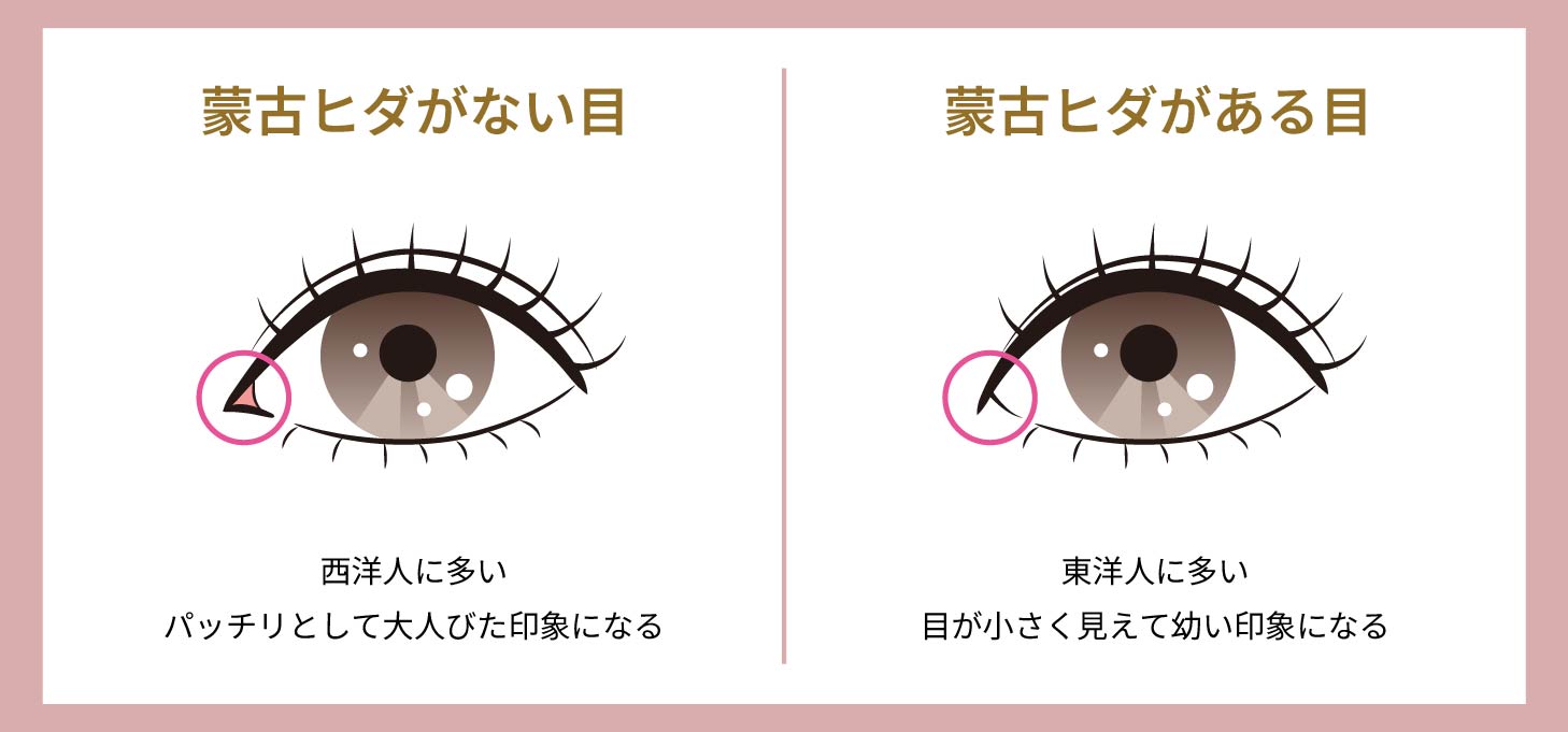 【セルフチェック】蒙古襞がある人・ない人の見分け方｜HAABクリニック