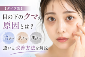 目の下のクマ　原因